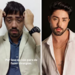 Rico Melquiades surpreende...